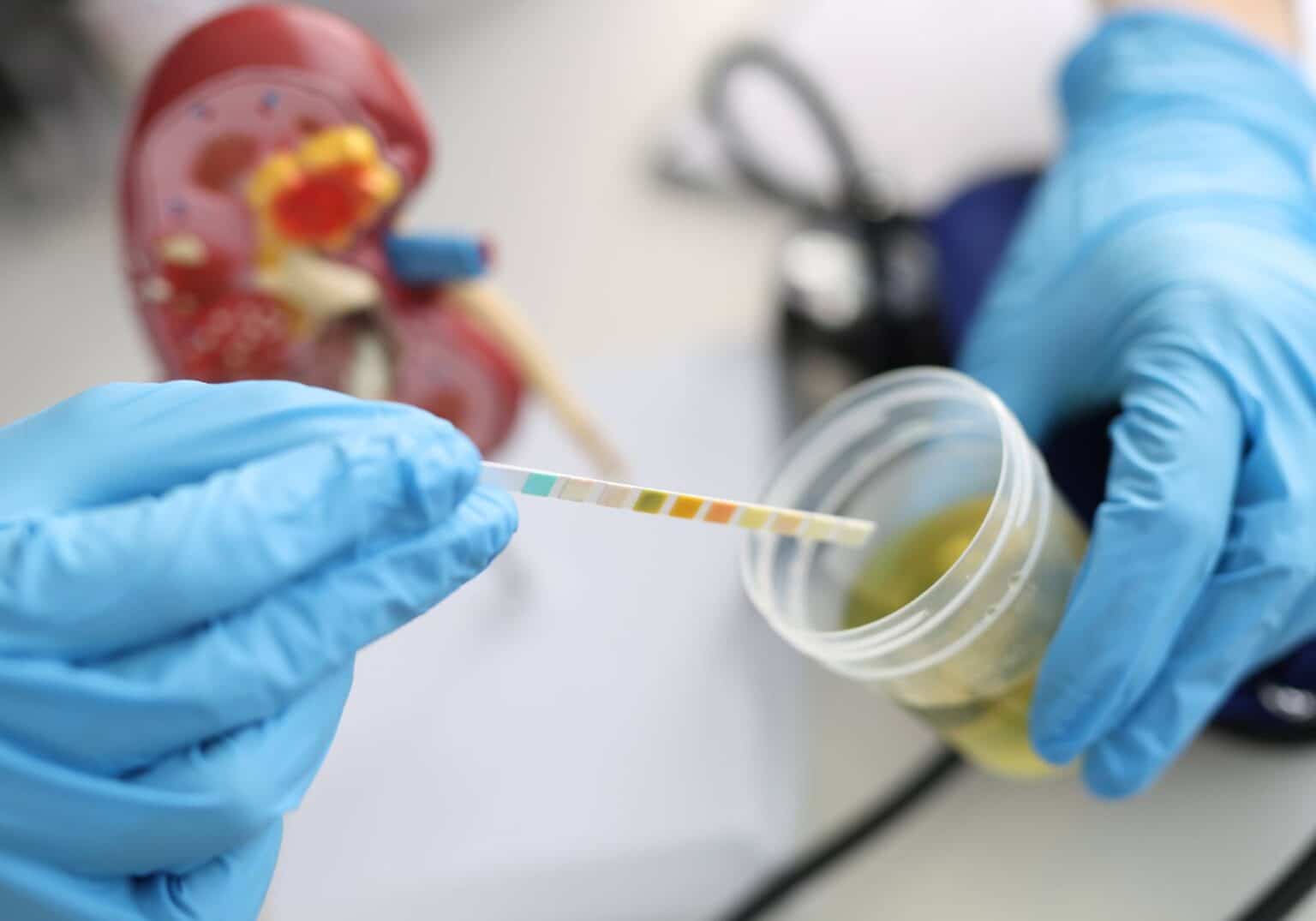 Does Kratom Show On A Drug Test Does Kratom Show Up On A Drug Test?