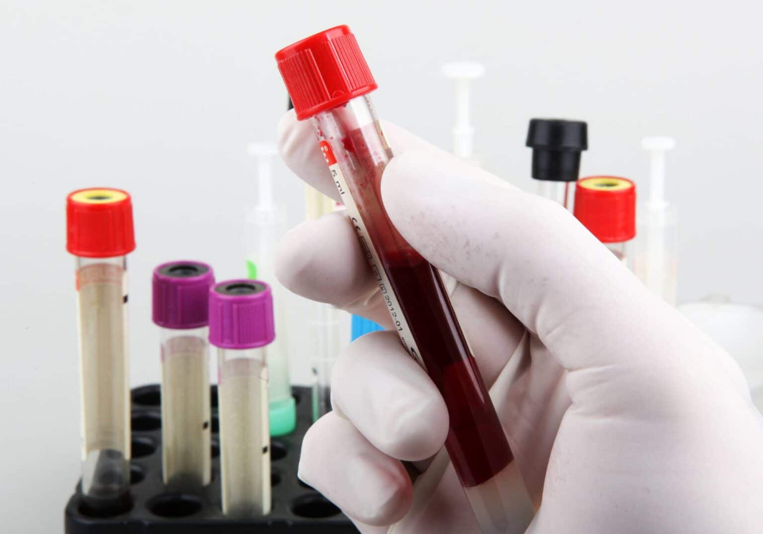 How Long Does Valium Stay in Your System?